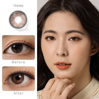 Magister Iris Honey Color 14.2mm FREE Lens Solution